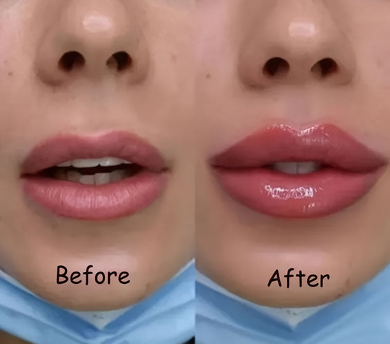 LipRelief™ Full Gloss – Hydrating Lip Care Serum - bodyrelief.uk