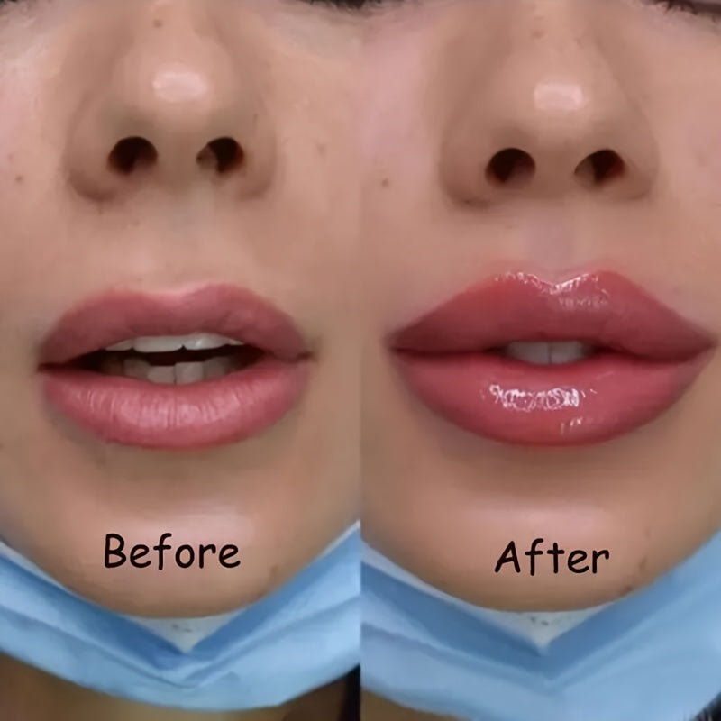 LipRelief™ Full Gloss – Hydrating Lip Care Serum
