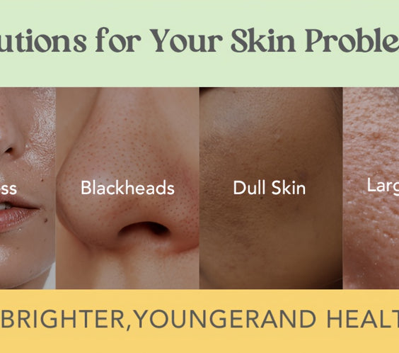 Neatique Face Masks Skincare Set, 480g (120gx4) - bodyrelief.uk