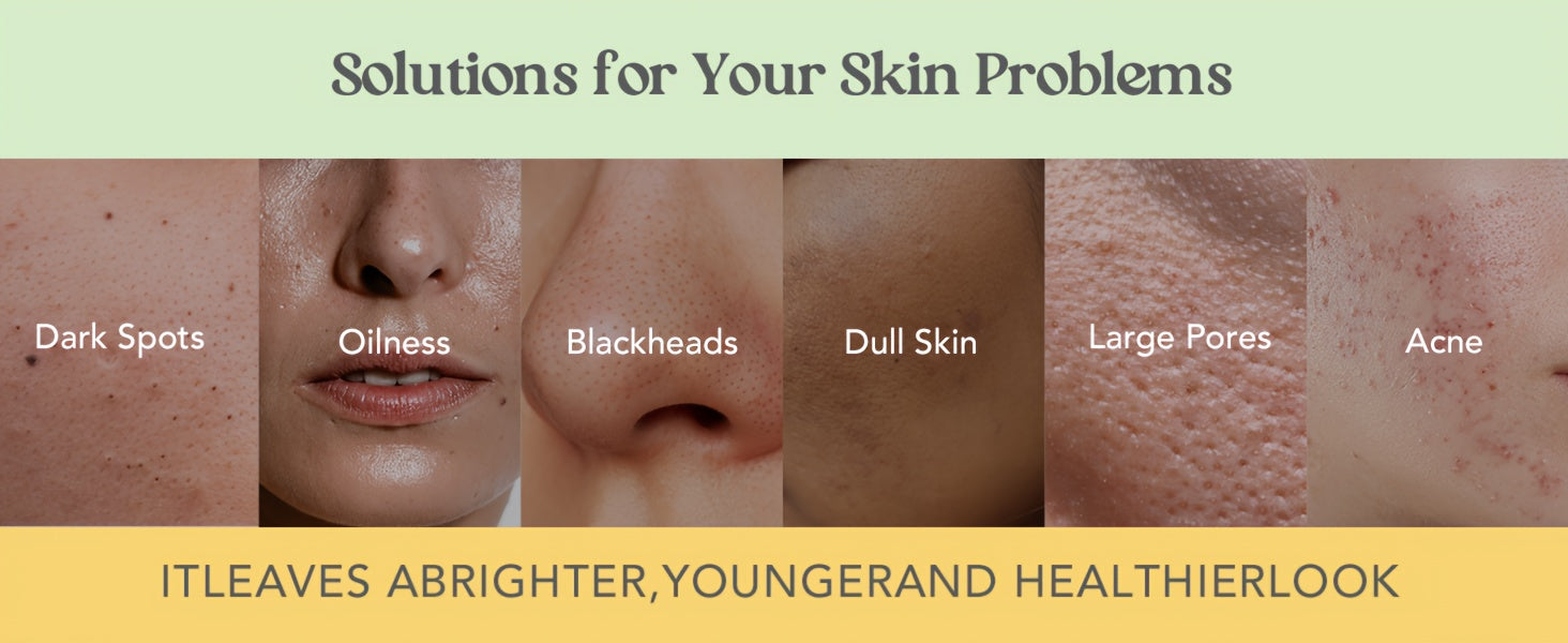 Neatique Face Masks Skincare Set, 480g (120gx4) - bodyrelief.uk