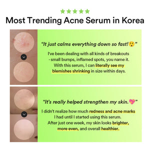 Heartleaf Teca Capsule Serum Calming Drop - bodyrelief.uk